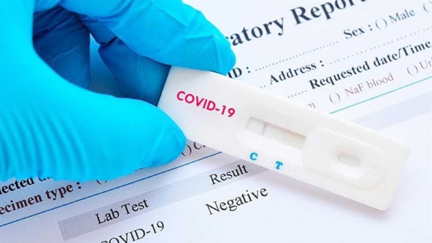 Cómo funciona el test